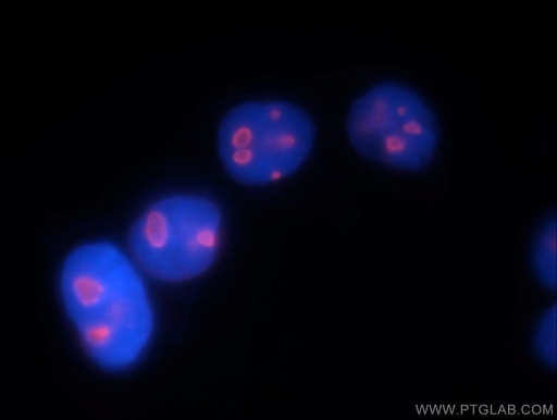 [10528-1-AP-150UL] DDX21 Polyclonal antibody