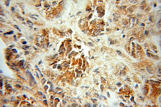 [10530-1-AP-20UL] PDLIM5 Polyclonal antibody