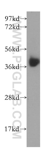 [10535-1-AP-150UL] B4GALT7 Polyclonal antibody