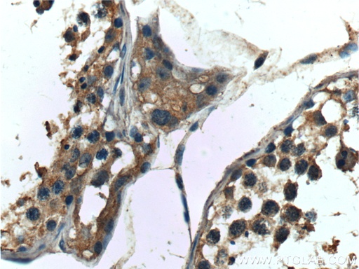 [10536-1-AP-150UL] DDR1 Polyclonal antibody