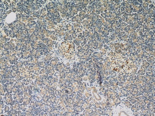 [10537-1-AP-150UL] Dermatopontin Polyclonal antibody
