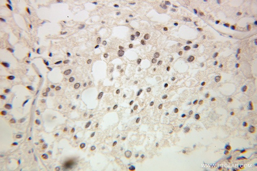 [10540-1-AP-20UL] GTF2A2 Polyclonal antibody