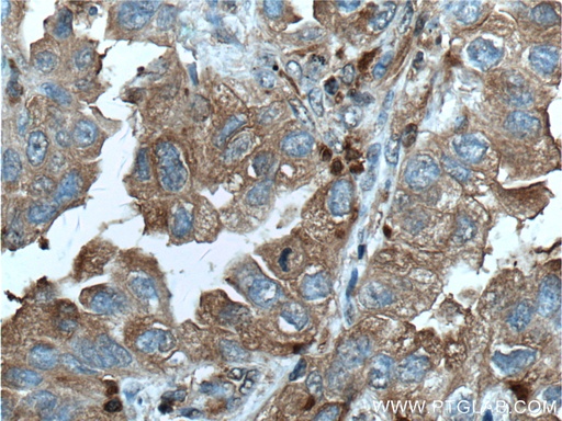 [10543-1-AP-150UL] PSME1 Polyclonal antibody