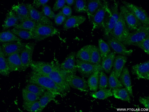 [10545-2-AP-150UL] peroxiredoxin 2 Polyclonal antibody