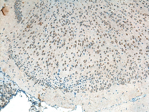 [10546-1-AP-150UL] Alpha SNAP Polyclonal antibody