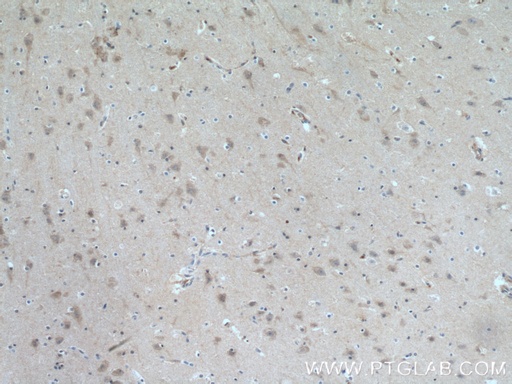 [10568-1-AP-150UL] ITPK1 Polyclonal antibody