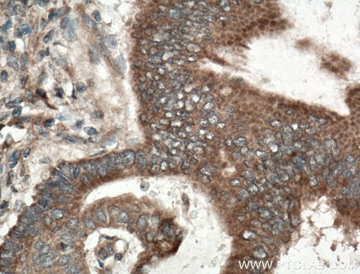 [10575-1-AP-20UL] RKIP Polyclonal antibody