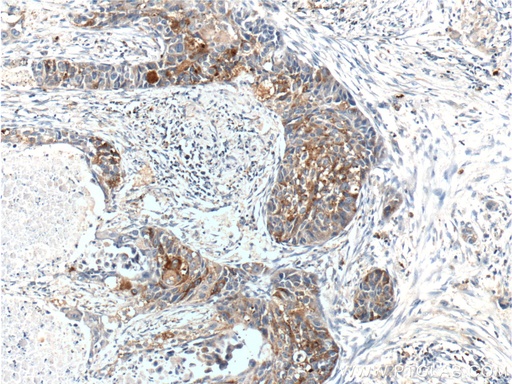 [10576-1-AP-150UL] RPN2 Polyclonal antibody