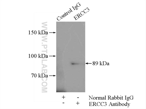 [10580-1-AP-150UL] ERCC3 Polyclonal antibody