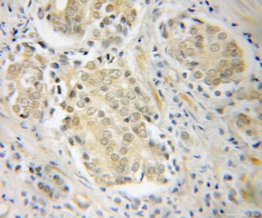 [10581-1-AP-20UL] POT1 Polyclonal antibody