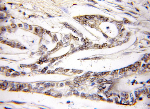 [10589-2-AP-20UL] PLCD4 Polyclonal antibody