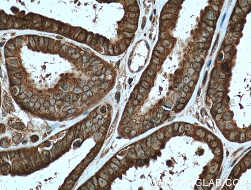[10591-1-AP-150UL] APOBEC3C Polyclonal antibody