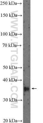 [10592-1-AP-150UL] DLX5 Polyclonal antibody