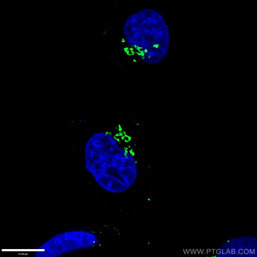 [10598-1-AP-20UL] GORASP2 Polyclonal antibody