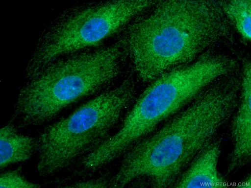 [10599-1-AP-150UL] BAG3 Polyclonal antibody
