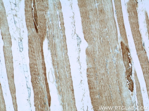 [10601-1-AP-150UL] AGPAT1 Polyclonal antibody