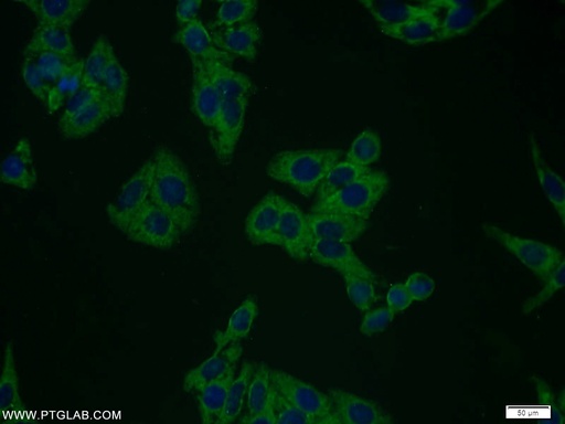[10602-1-AP-150UL] Plexin B2 Polyclonal antibody