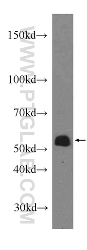 [10611-2-AP-150UL] COX10 Polyclonal antibody