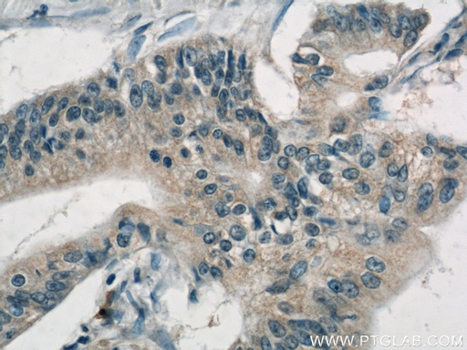 [10618-1-AP-20UL] AP1M2 Polyclonal antibody
