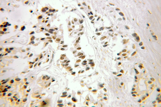 [10623-1-AP-150UL] FUBP3 Polyclonal antibody
