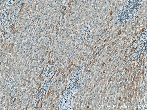 [10626-1-AP-150UL] FBXO44 Polyclonal antibody