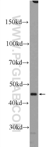 [10631-1-AP-150UL] RXRA Polyclonal antibody