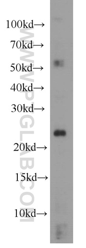 [10632-1-AP-150UL] RHOC Polyclonal antibody