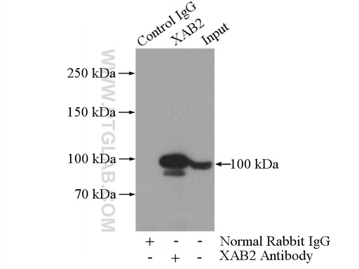 [10637-1-AP-150UL] XAB2 Polyclonal antibody