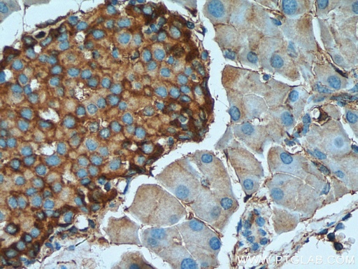 [10004-2-IG-150UL] Marcks Polyclonal antibody
