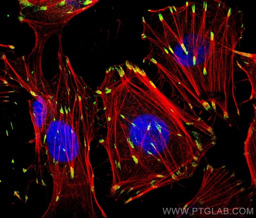 [10029-1-IG-20UL] Paxillin Polyclonal antibody