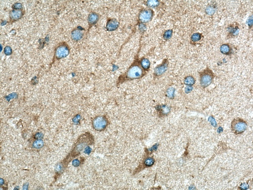 [10030-2-AP-20UL] Dynamitin (69-376 AA) Polyclonal antibody