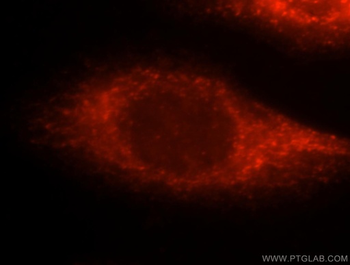 [10037-1-IG-20UL] XIAP Polyclonal antibody