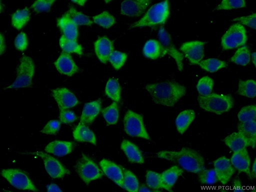 [10045-1-IG-20UL] GRB7 Polyclonal antibody