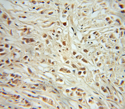 [10048-2-IG-20UL] RB1 Polyclonal antibody