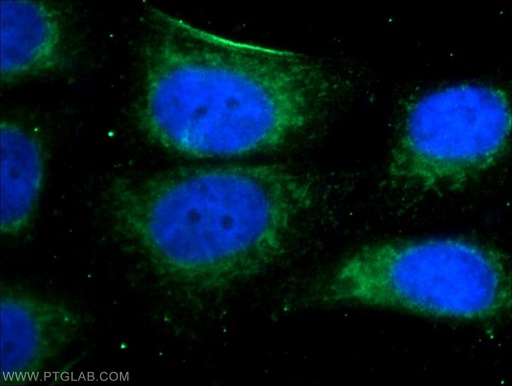 [10056-1-AP-150UL] MEF2C Polyclonal antibody