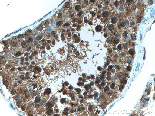 [10060-1-AP-150UL] FKBPL Polyclonal antibody