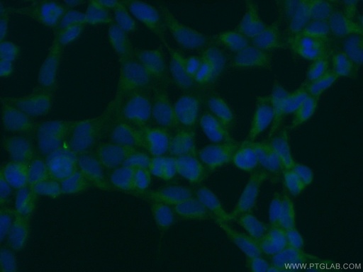 [10061-1-AP-20UL] OS9 Polyclonal antibody