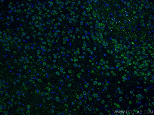 [10062-2-AP-20UL] Notch1 Polyclonal antibody