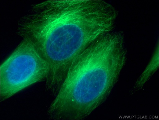 [10068-1-AP-150UL] Beta Tubulin Polyclonal antibody