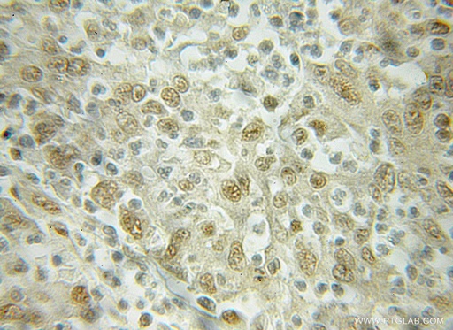 [10077-1-AP-150UL] Importin Beta Polyclonal antibody