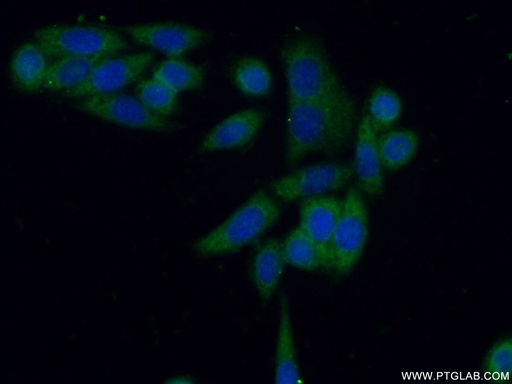 [10078-2-AP-20UL] PKM Polyclonal antibody