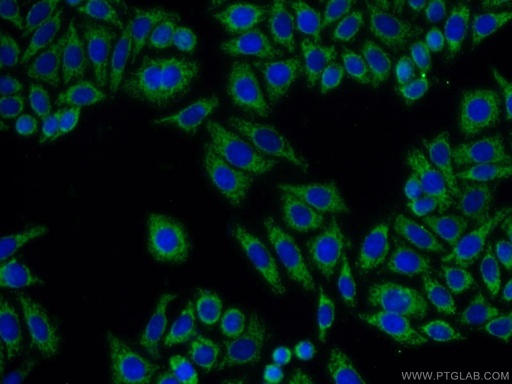 [10081-1-AP-20UL] GNB3 Polyclonal antibody