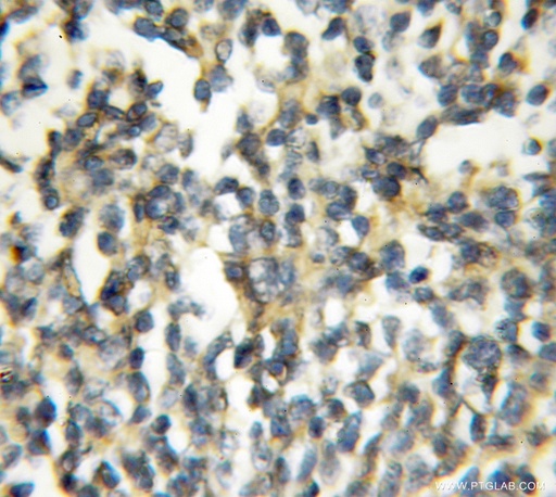 [10085-1-AP-150UL] PAFAH2 Polyclonal antibody