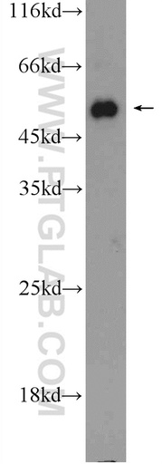 [10086-1-AP-20UL] ACVR1B Polyclonal antibody