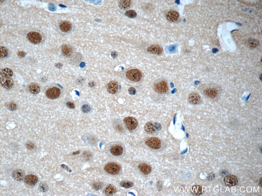 [10089-2-AP-150UL] COPS8/COP9 Polyclonal antibody