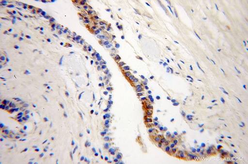 [10090-2-AP-150UL] ARL2BP Polyclonal antibody