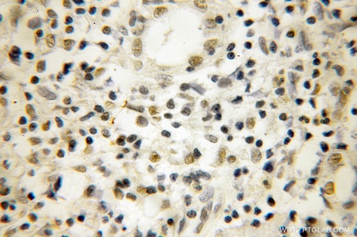 [10091-2-AP-20UL] NOB1 Polyclonal antibody