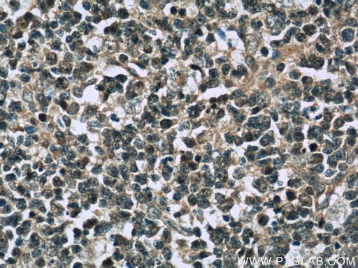 [10097-2-AP-20UL] TFPT Polyclonal antibody