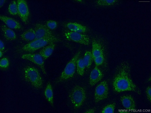 [10101-2-AP-20UL] PITRM1 Polyclonal antibody