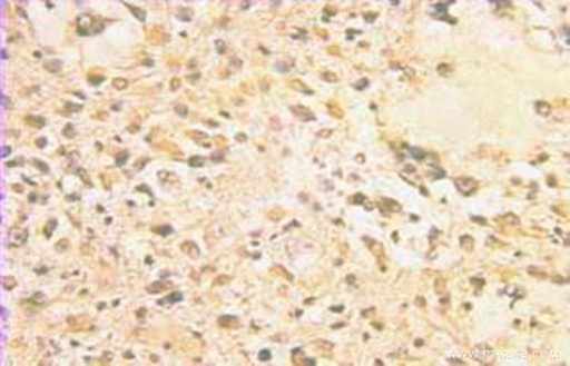 [10104-1-AP-20UL] GPAA1 Polyclonal antibody